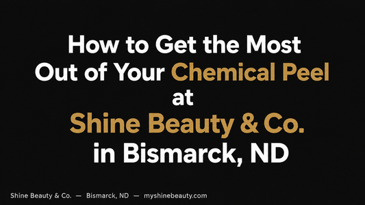 How to Get the Most Out of Your Chemical Peel at Shine Beauty & Co. in Bismarck, ND